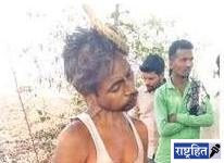 कुऱ्हाडीने वार करून पत्नीवर केला जीवघेणा हल्ला! नंतर पतीने केली आत्महत्या